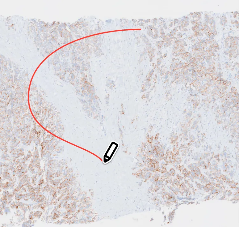 Overview workflow step 2