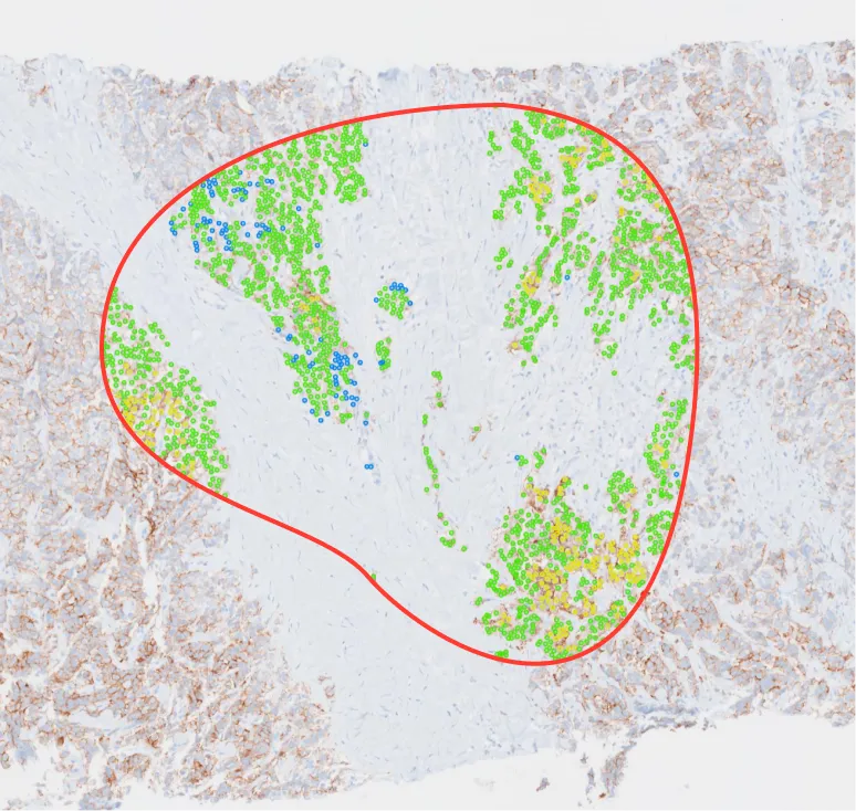 Overview workflow step 3